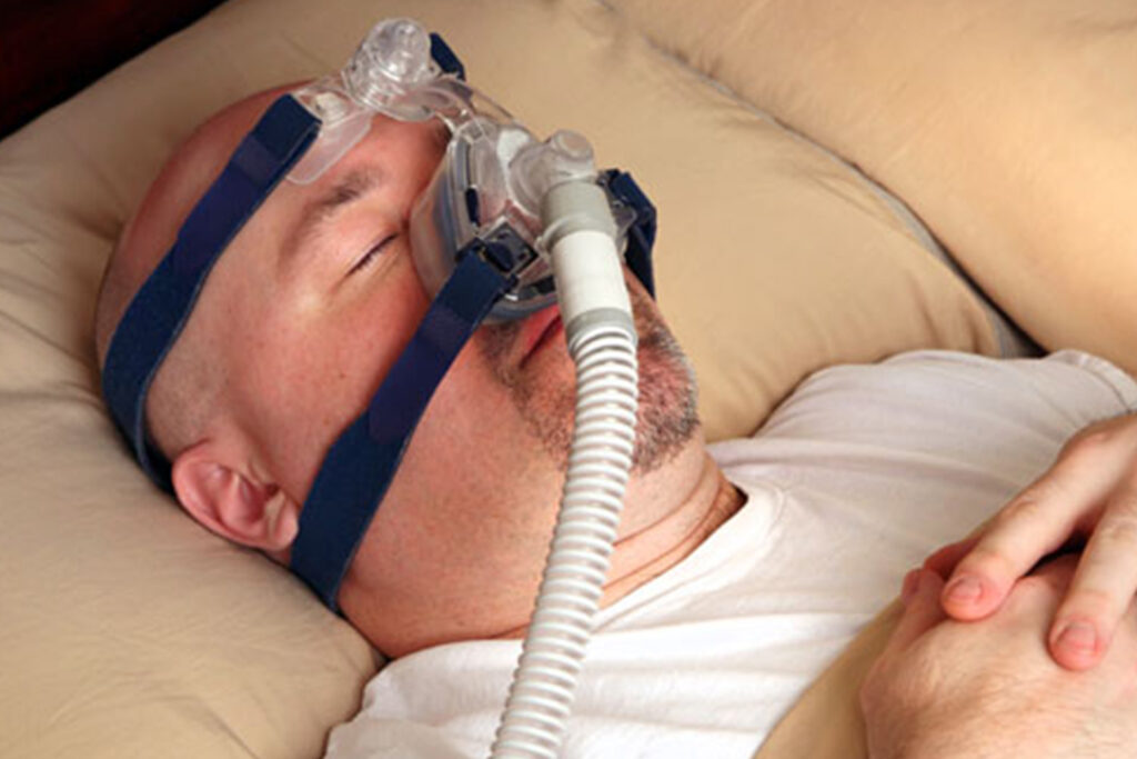 Schäafender Patient mit Maske zur Schlafdiagnostik